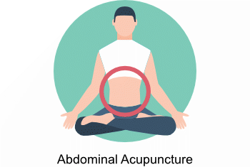 Abdominal Acupuncture