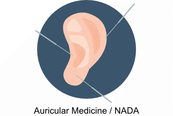 Auricular Medicine/NADA